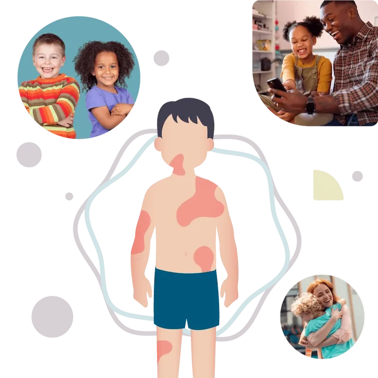 Pedskin Research – pediatric skin care solutions Pedskin Research pediatric skin diseases