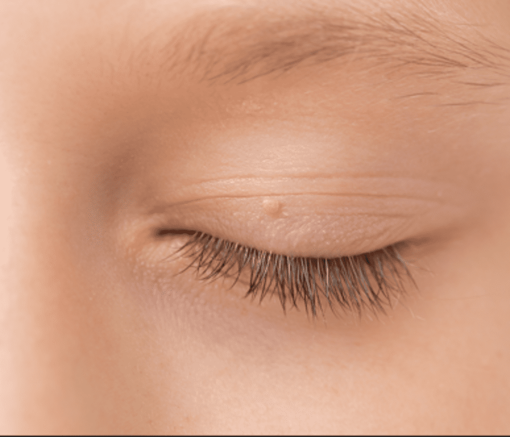 Pedskin Research pediatric skin care solutions