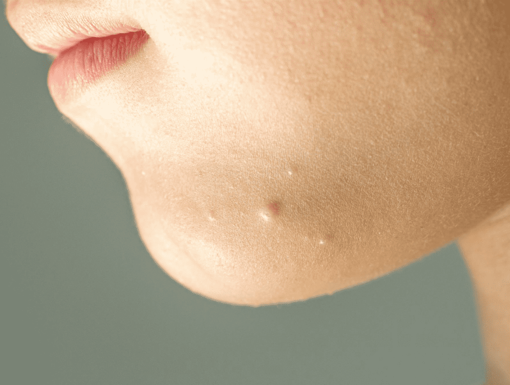 Pedskin Research pediatric dermatology