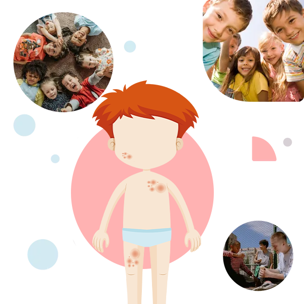 Pedskin Research – clinical dermatology studies Pedskin Research child skin care