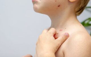 Pedskin Research clinical dermatology studies