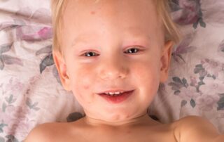 Pedskin Research clinical dermatology studies