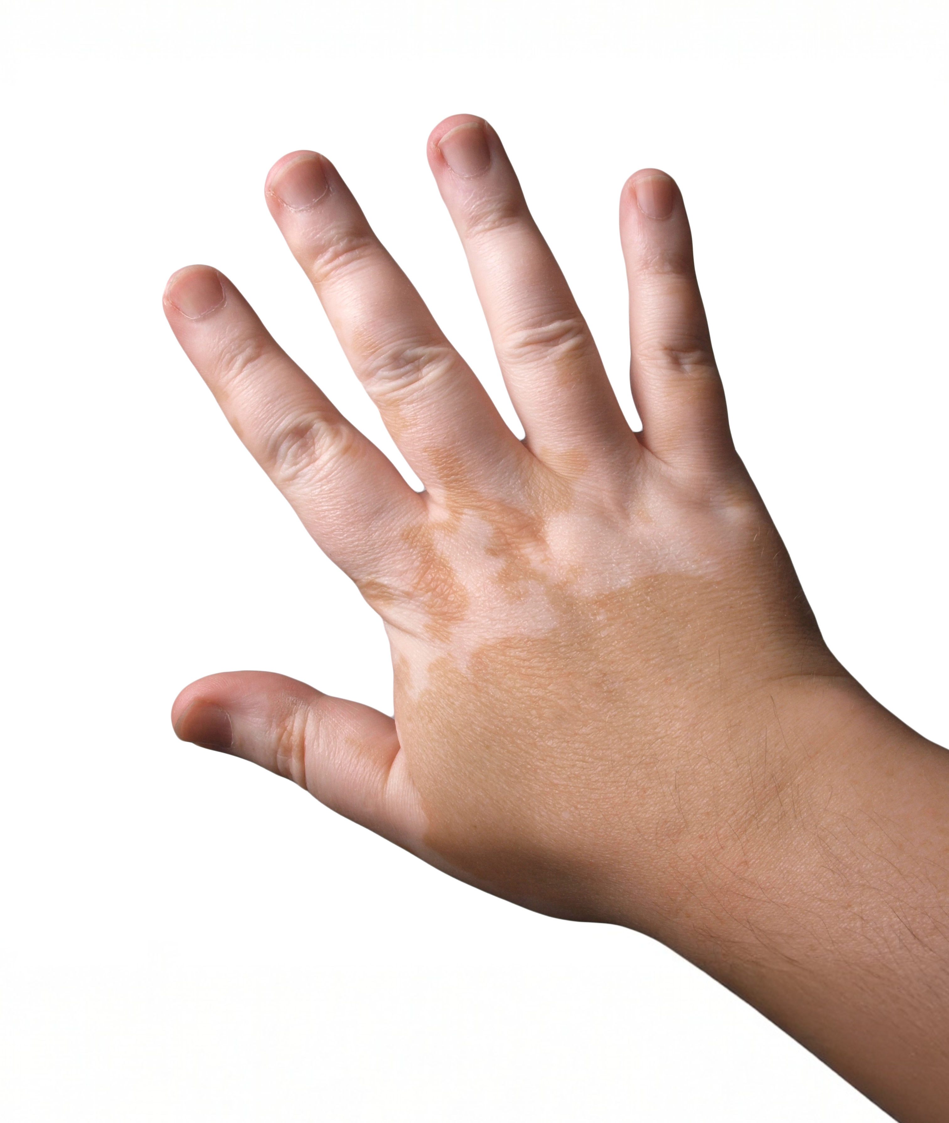 Pedskin Research – pediatric skin care solutions Pedskin Research children’s skin health