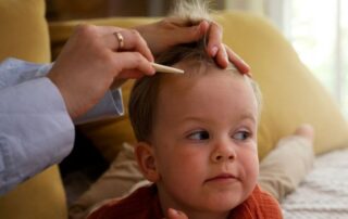 Parent or caregiver examining a child’s scalp for signs of alopecia areata, highlighting pediatric hair loss and dermatology care.